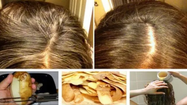 Cara Alami ubah uban jadi hitam kembali