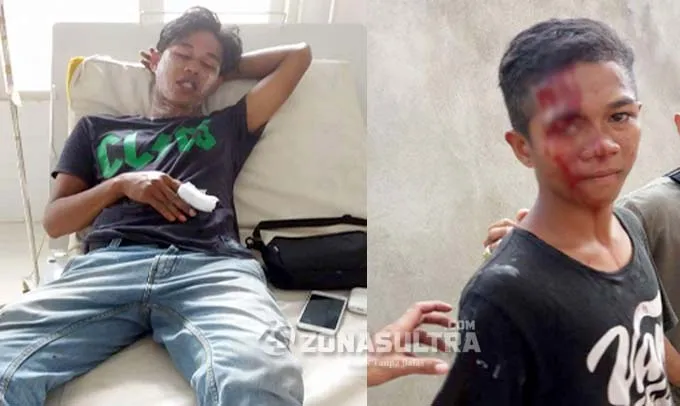 Aksi Demo KPU Bombana Berakhir Bentrok dan Dua Orang Terluka