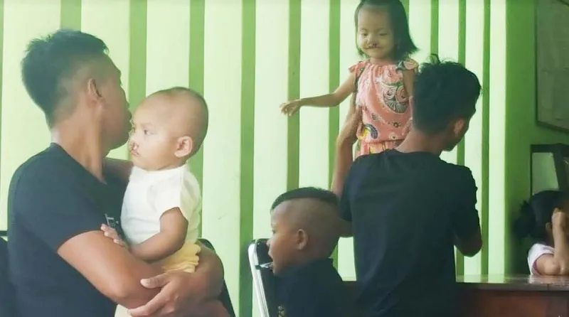 24 Warga Sultra Jalani Operasi Bibir Sumbing Gratis