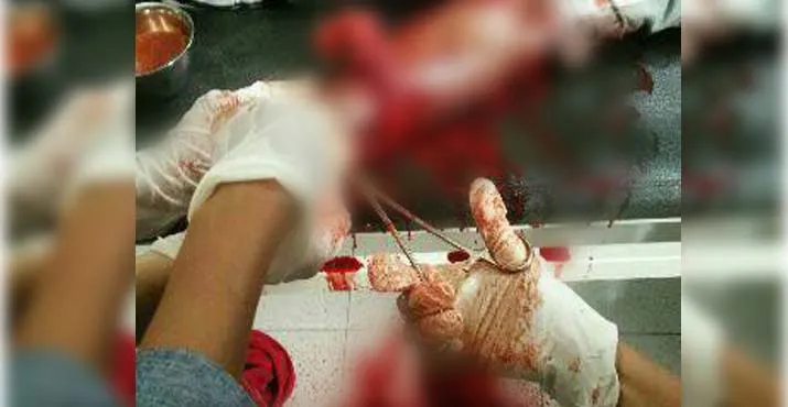 Tahanan Polsek Pakue Mencoba Bunuh Diri