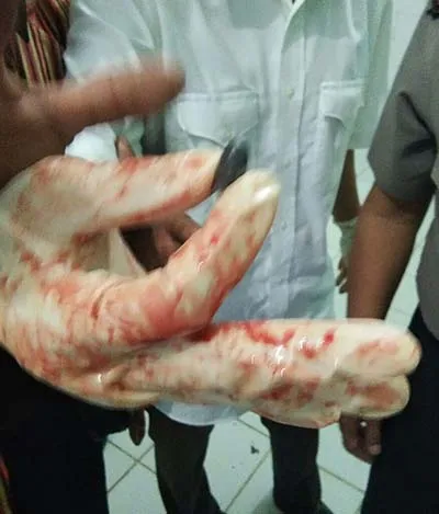 Anggotanya Tembak Seorang Warga Hingga Tewas, Ini Penjelasan Kapolres Muna