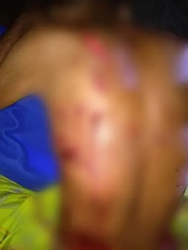 Sedang Mandi di Kali, Pria di Butur Ini Digigit Buaya