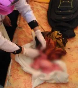 Bayi Perempuan Dalam Tas Ditemukan di Pos Kehutanan Konsel