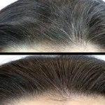 Uban Jadi Hitam Kembali Dalam Hitungan Menit Rambut beruban jadi hitam kembali