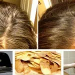 uban jadi hitam cara alami