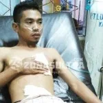 Tersengat Listrik, Lengan dan Dada Pemuda Ini Hangus Terbakar Tersengat Listrik, Lengan dan Dada Pemuda Ini Hangus Terbakar