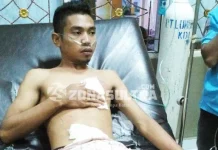 Tersengat Listrik, Lengan dan Dada Pemuda Ini Hangus Terbakar Tersengat Listrik, Lengan dan Dada Pemuda Ini Hangus Terbakar