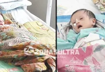 Bayi Kembar Gizi Buruk Diperbolehkan Pulang Bayi Kembar Gizi Buruk Diperbolehkan Pulang