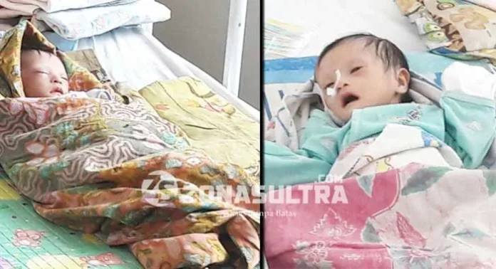 Bayi Kembar Gizi Buruk Diperbolehkan Pulang