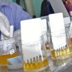 68 Orang Pegawai BPOM Kendari Dites Urine ilustrasi tes urine