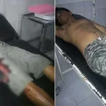 Bertikai Dengan Tetangga Kampung, Dua Pemuda Desa Pusawah Kena Busur