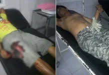 Bertikai Dengan Tetangga Kampung, Dua Pemuda Desa Pusawah Kena Busur