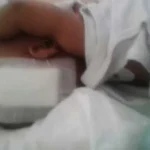 Bayi Penderita Tumor Asal Kendari Berhasil Dioperasi bayi-anita-puteri