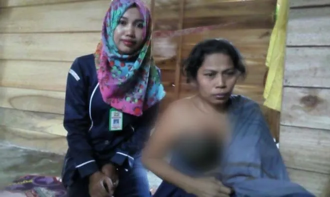 kanker_payu_darah Manda (35) Desa Lalowosula Kecamata Ladongi Kabupaten Kolaka Timur (Koltim) menderita kanker payu dara. Manda membutuhkan uluran tangan untuk operasi dan biaya pengobatan. .(JASPIN/ZONASULTRA.COM)