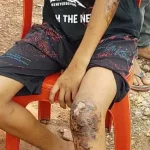 Nikmati Malam Tahun Baru di Tanjung Taipa, Empat Remaja Konut Dianiaya Nikmati Malam Tahun Baru di Tanjung Taipa, Empat Remaja Konut Dianiaya