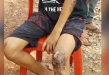 Nikmati Malam Tahun Baru di Tanjung Taipa, Empat Remaja Konut Dianiaya Nikmati Malam Tahun Baru di Tanjung Taipa, Empat Remaja Konut Dianiaya