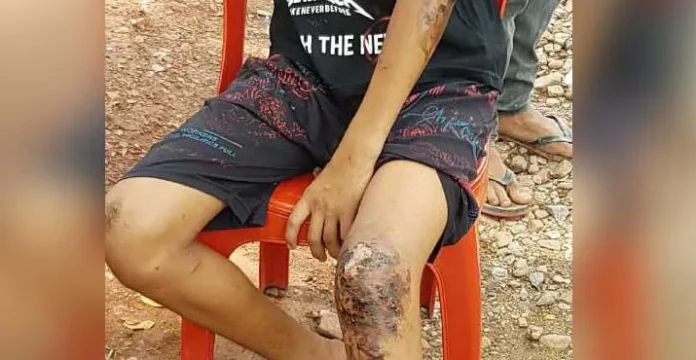 Nikmati Malam Tahun Baru di Tanjung Taipa, Empat Remaja Konut Dianiaya