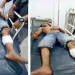 Mencoba Kabur, Tersangka Curanmor Dihadiah Timah Panas Mencoba Kabur, Tersangka Curanmor Dihadiah Timah Panas