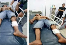 Mencoba Kabur, Tersangka Curanmor Dihadiah Timah Panas Mencoba Kabur, Tersangka Curanmor Dihadiah Timah Panas