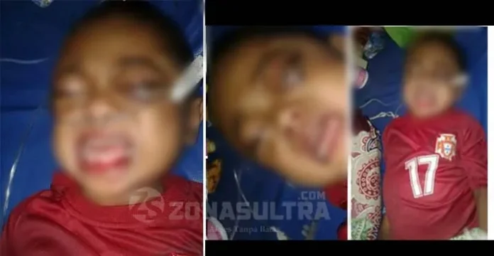 Menderita Leukimia dan Kanker, Bocah Asal Wakatobi Ini Membutuhkan Uluran Tangan