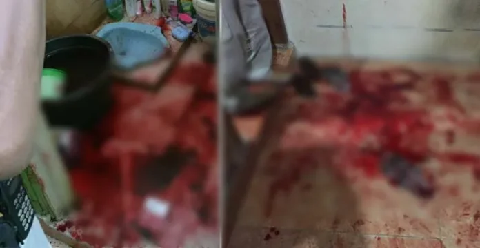 Diduga Selingkuhi Istri Orang, Pria Ini Ditebas Orang Tak Dikenal