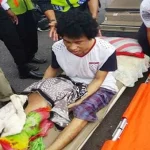 Presiden Jokowi Akan Besuk Si Dudung Penderita Tumor Asal Wakatobi Presiden Jokowi Akan Besuk Si Dudung Penderita Tumor Asal Wakatobi