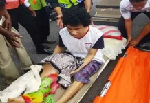 Presiden Jokowi Akan Besuk Si Dudung Penderita Tumor Asal Wakatobi Presiden Jokowi Akan Besuk Si Dudung Penderita Tumor Asal Wakatobi