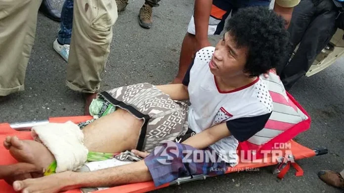 Menteri Susi Boyong Nelayan Wakatobi Penderita Tumor Tulang Berobat ke Jakarta