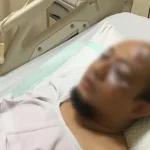 Penyidik Senior KPK Disiram Air Keras Oleh Orang Tak Dikenal Sepulang Dari Masjid Penyidik Senior KPK Disiram Air Keras Oleh Orang Tak Dikenal Sepulang Dari Masjid