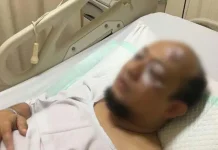 Penyidik Senior KPK Disiram Air Keras Oleh Orang Tak Dikenal Sepulang Dari Masjid Penyidik Senior KPK Disiram Air Keras Oleh Orang Tak Dikenal Sepulang Dari Masjid