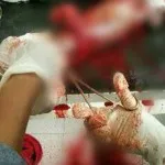 Tahanan Polsek Pakue Mencoba Bunuh Diri Tahanan Polsek Pakue Mencoba Bunuh Diri