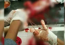 Tahanan Polsek Pakue Mencoba Bunuh Diri Tahanan Polsek Pakue Mencoba Bunuh Diri