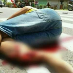 Ditabrak Saat Jemput Anak, Pria Ini Mengalami Patah Kaki Ditabrak Saat Jemput Anak, Pria Ini Mengalami Patah Kaki