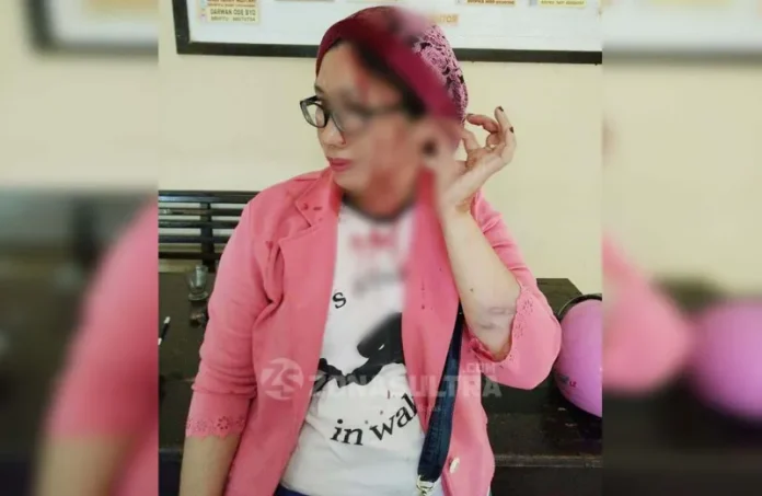 Korban_KDRT__wakatobi Gegara Aniaya Isteri, Pria Asal Wakatobi Ini Dilaporkan ke Polisi