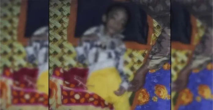 Menderita Tumor Otak, Bocah Asal Wakatobi Ini Butuh Uluran Tangan