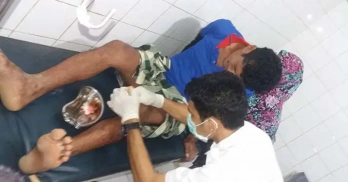 Hendak Mandi di Permandian Sangia, Pria Ini Digigit Buaya