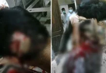 Tolak Beri Uang, Tukang Ojek Dikeroyok 3 Lelaki Pakai Senjata Tajam Tolak Beri Uang, Tukang Ojek Dikeroyok 3 Lelaki Pakai Senjata Tajam