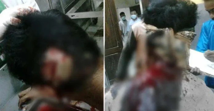 Tolak Beri Uang, Tukang Ojek Dikeroyok 3 Lelaki Pakai Senjata Tajam