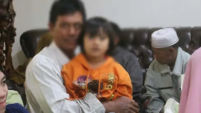 Antam UBPN Sultra Bantu Operasi 20 Anak Penderita Bibir Sumbing