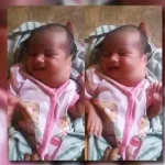 Derita Tumor di Lehernya, Bayi Asal Wakatobi Ini Butuh Uluran Tangan Budiman Asifaa, bayi berusia tiga bulan asal kabupaten Wakatobi ini membutuhkan bantuan dana untuk membiayai perawatan medis akibat tumor di lehernya. (ISTIMEWA)