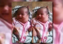 Derita Tumor di Lehernya, Bayi Asal Wakatobi Ini Butuh Uluran Tangan Budiman Asifaa, bayi berusia tiga bulan asal kabupaten Wakatobi ini membutuhkan bantuan dana untuk membiayai perawatan medis akibat tumor di lehernya. (ISTIMEWA)