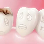 Tidak Ingin Gigi Anda Lubang? Jaga Kesehatan Gigi dan Mulut