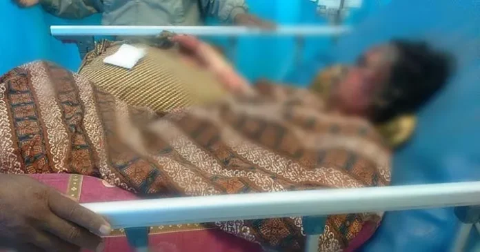 ibunda_terbakar Ibunda Balita yang Terbakar di Konut Akan Dioperasi Sore Ini