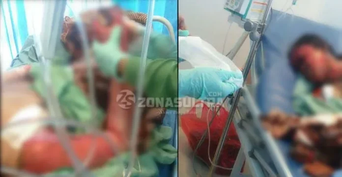 Pasca Operasi, Ibu Korban Pembakaran di Konut Masih Koma