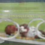 Bayi Perempuan Asal Konsel Diduga Mengidap Penyakit Langka Bayi Perempuan Asal Konsel Diduga Mengidap Penyakit Langka