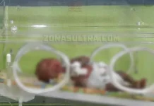 Bayi Perempuan Asal Konsel Diduga Mengidap Penyakit Langka Bayi Perempuan Asal Konsel Diduga Mengidap Penyakit Langka