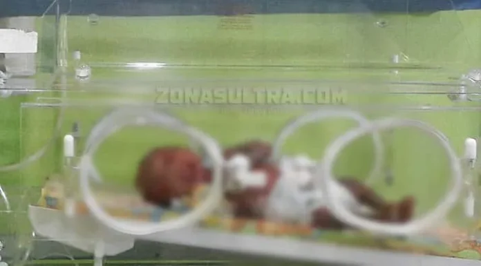 Bayi Perempuan Asal Konsel Diduga Mengidap Penyakit Langka