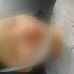 Diduga Korban Tabrak Lari, Wanita Asal Konsel Ini Ditemukan Tewas di Jalan Diduga Korban Tabrak Lari, Wanita Asal Konsel Ini Ditemukan Tewas di Jalan