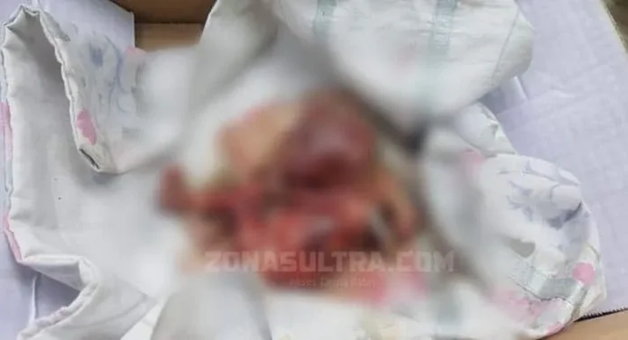 Orok Diduga Hasil Aborsi Ditemukan Penambang Pasir