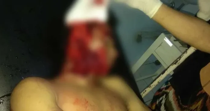 Korban Cemburu, Pemuda Asal Sinjai Ini Tewas Dibacok